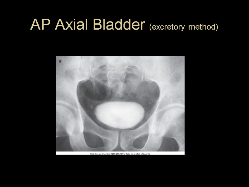 AP Axial Bladder (excretory method)